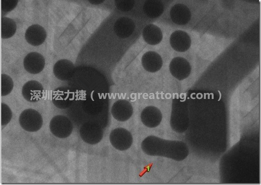 BGA因?yàn)楹笁|變小，造成錫膏過多而最終形成焊接短路的結(jié)果。